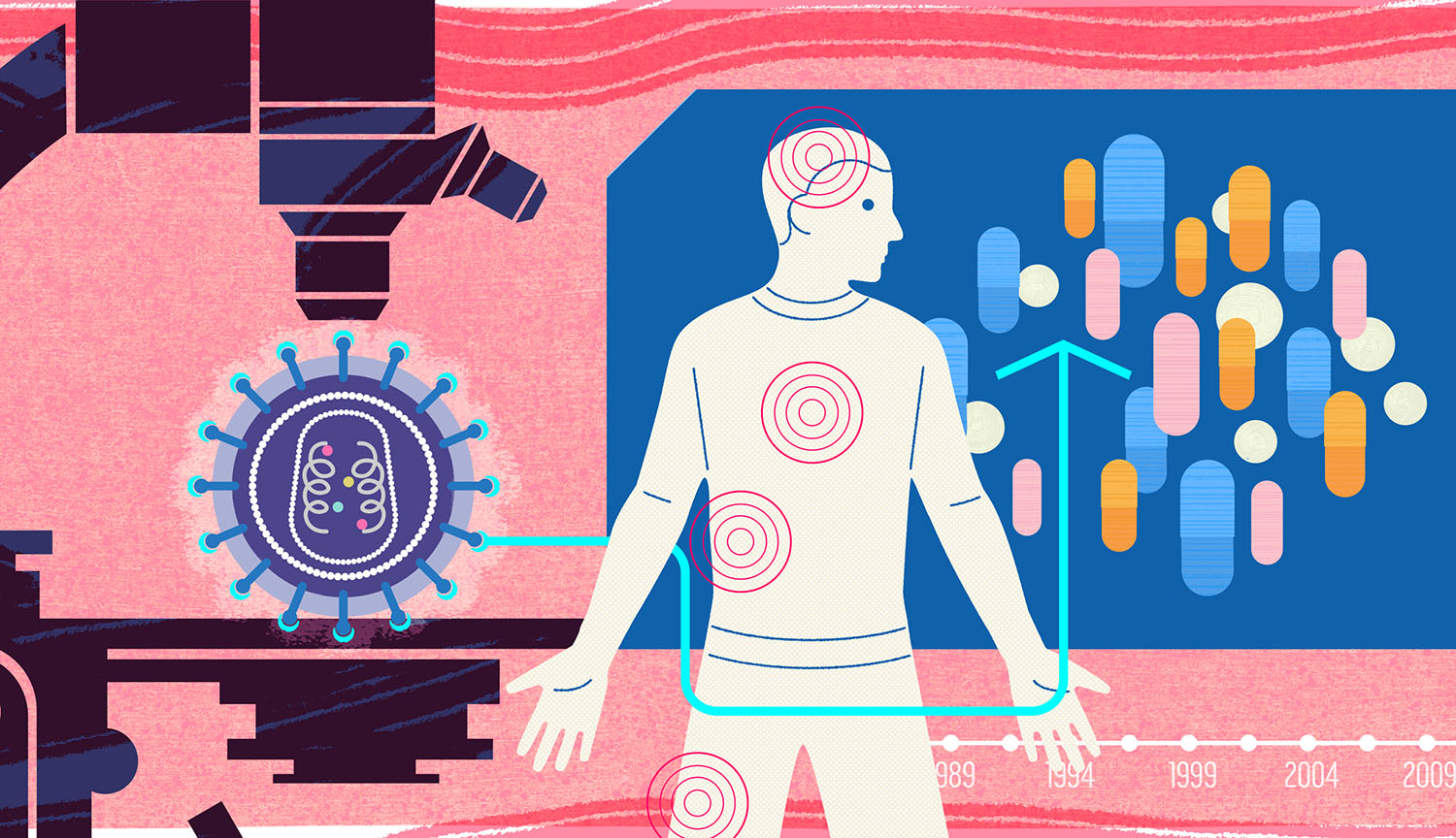 Conceptual collage shows HIV virus, infected person, images of pills and microscope.