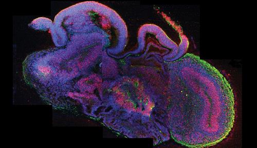 Image of a blobby structure with various layers and protrusions, colored purple, pink, red and green.