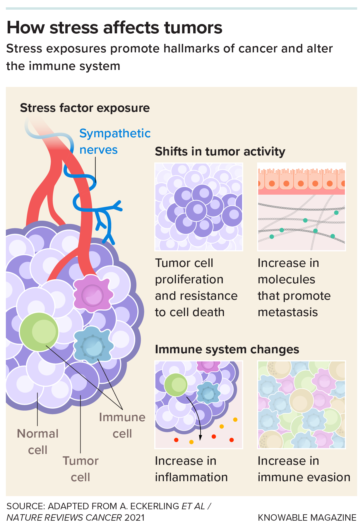 Diagram showing a tumor and four ways stress can affect cancer growth.