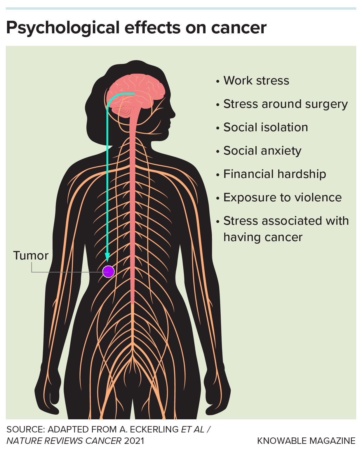 Outline of a person showing their nervous system, brain and tumor shows a list of potential stressors that can affect tumor growth.